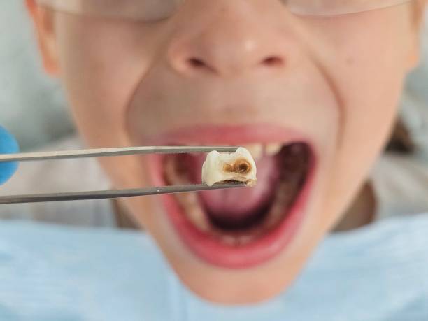 Best Cosmetic Emergency Dentistry in Lenoir City, TN